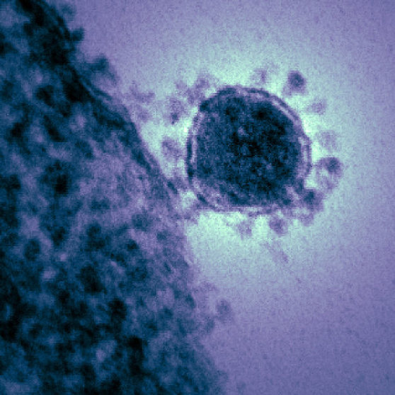 600px-Coronavirus